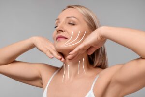 Close up of woman’s flawless face after facelift, with arrows arrows on her face and neck where she was treated